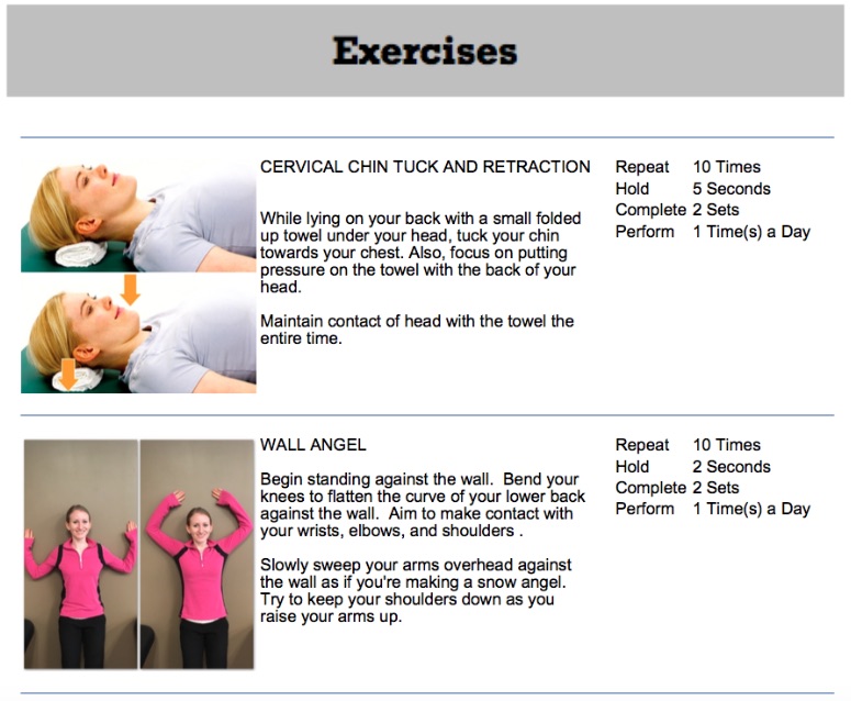 oakville chiropractor thoracic outlet syndrome exercises