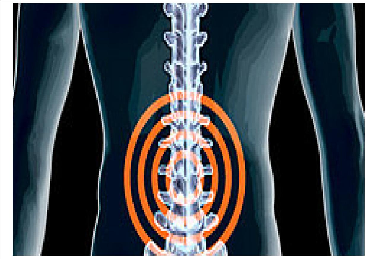 Artistic Can Chiropractor Make Spinal Stenosis Worse Background for Mobile Artistic Can Chiropractor Make Spinal Stenosis Worse Background for Mobile