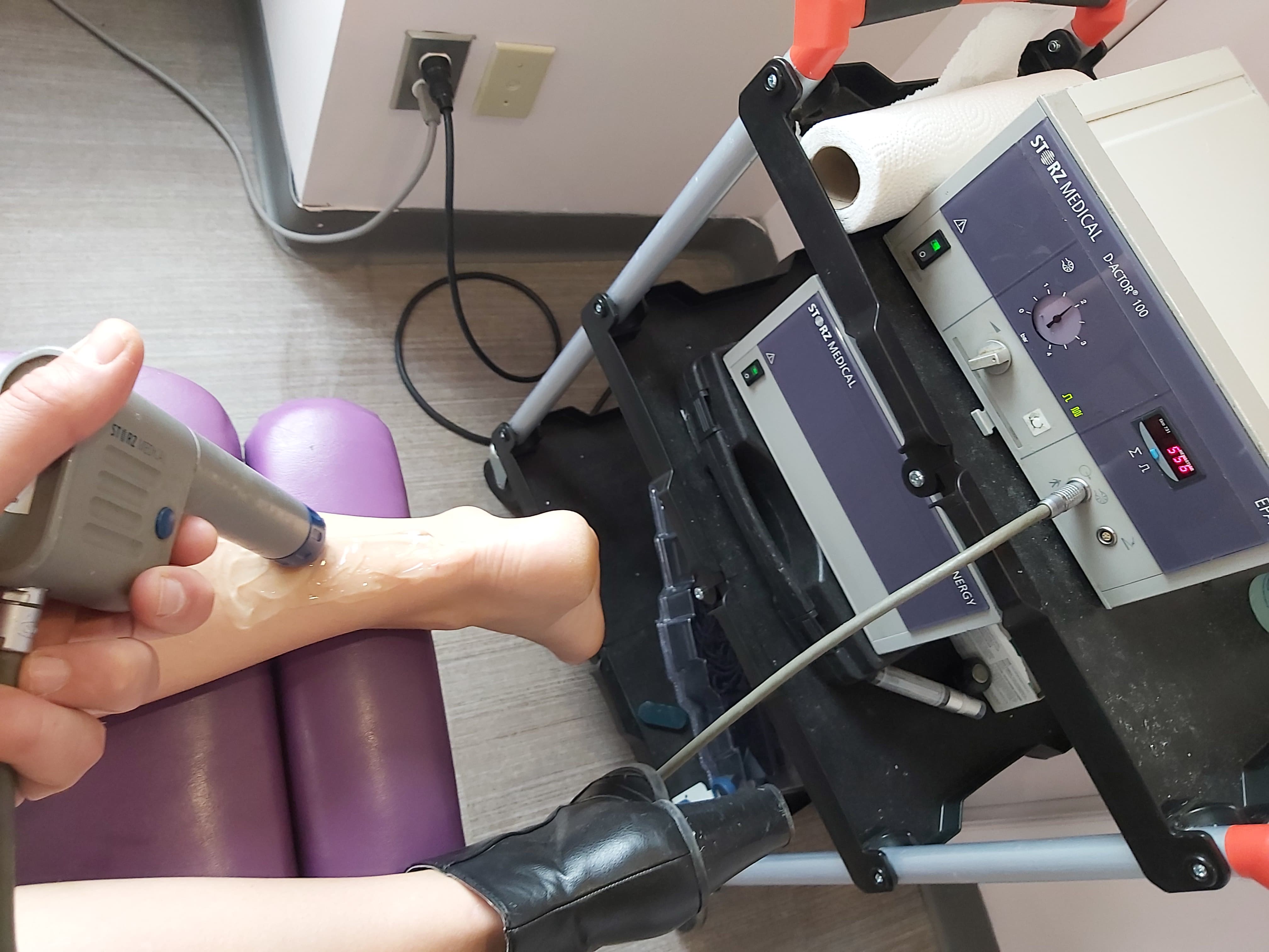 shockwave gun being used on females calf muscle for plantar fasciitis treatment