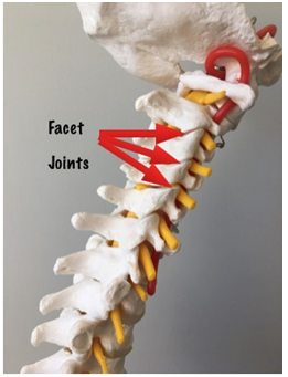 neck pain treatment facet joint pain