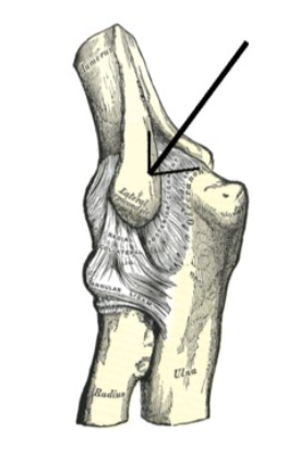 chiropractor oakville medial elbow pain