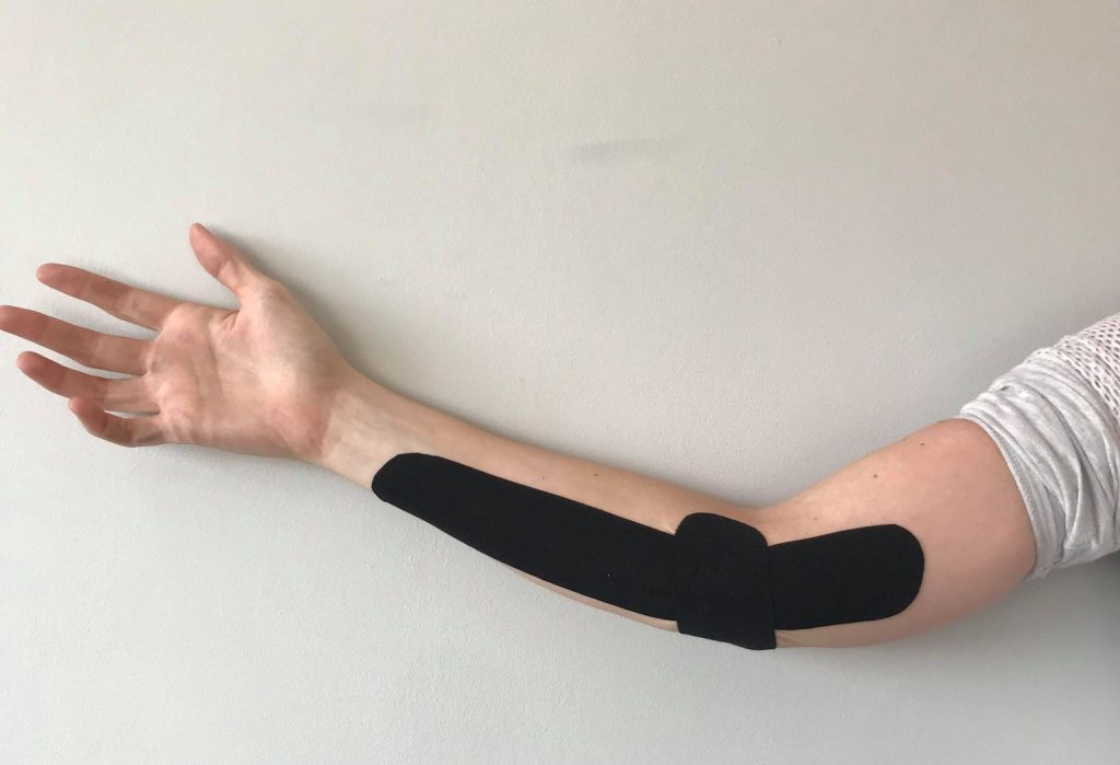 a patients elbow who is taped on the inside of the forearm and elbow to help with golfers elbow