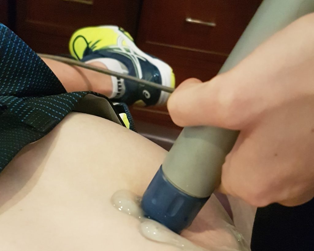 shockwave therapy on a patients glutes to help sciatic pain