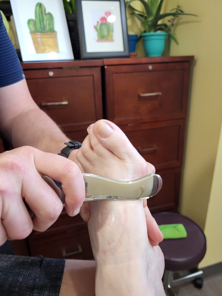 A scraping tool being used on a patients bunion.