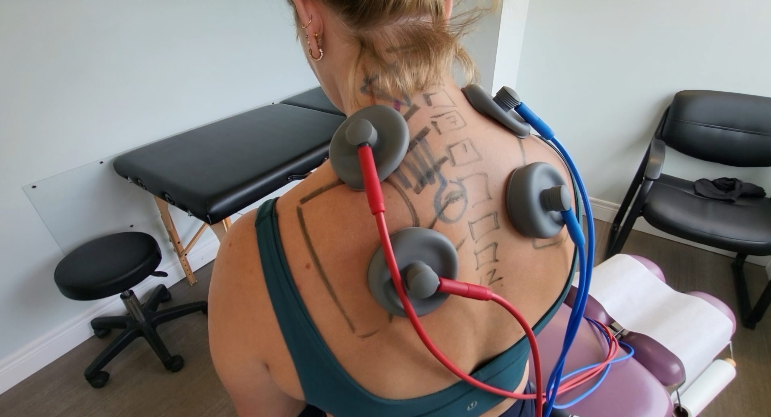 female patient with a suction ifc on her neck