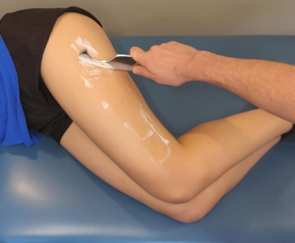a scraping tool being used on a chiropractic patients upper leg and IT Band