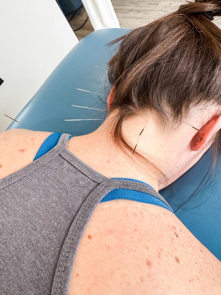 acupuncture for neck and jaw pain