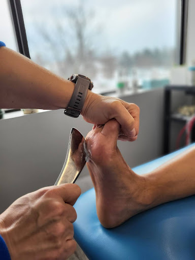 Clinician performing instrument-assisted soft tissue treatment on the arch of a patient’s foot.