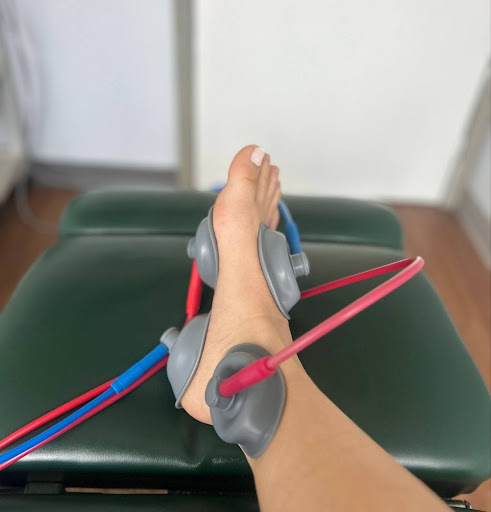 Electrical stimulation pads placed on a patient’s foot and ankle during therapy on a treatment table.