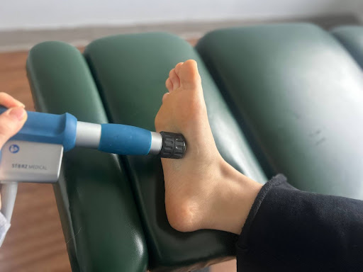 foot receiving shockwave therapy for arch pain