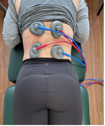 suction ifc machine on a female patients low back for herniated disc treatment in Oakville