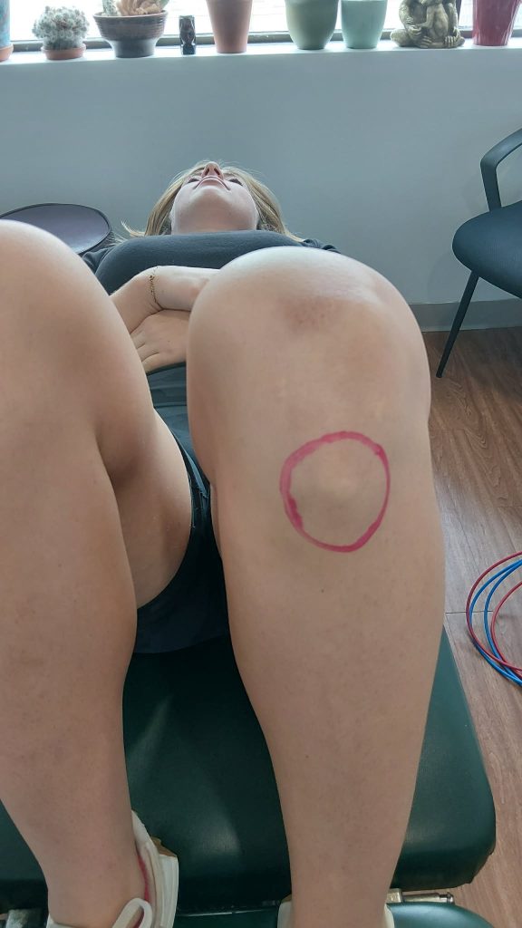 Osgood Schlatters knee pain circled in red below the knee cap